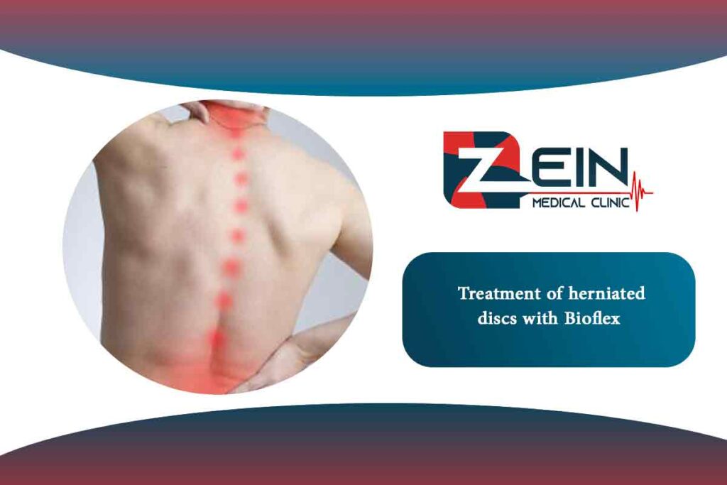 Herniated Disk Treatment With Bioflex Zein Hospital