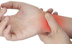what is carpal tunnel syndrome and how is it treated