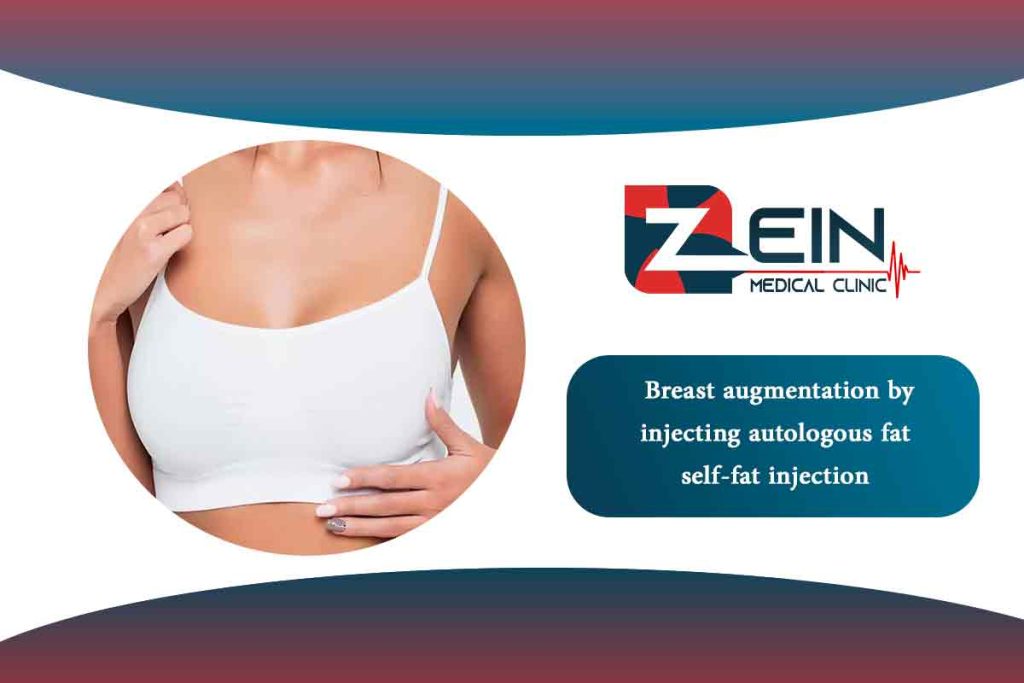 Fat Transfer Breast Augmentation - Zein Hospital