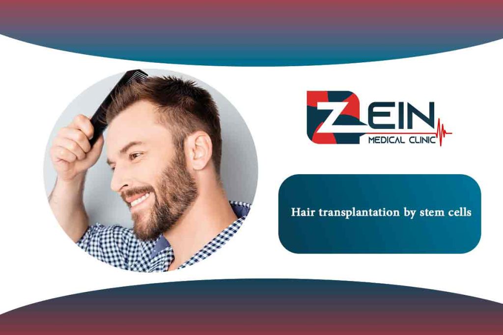 Stem Cell Hair Transplant Zein Hospital