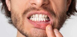 What are the risks of gum implants?