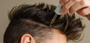 Prepare to avoid the possible side effects of hair transplantation