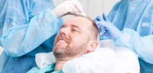 Technical improvements in hair transplantation and their impact on side effects