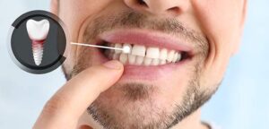 What are the risks and complications of dental implants?