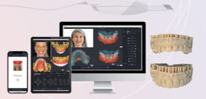 The role of technology in achieving the perfect smile design