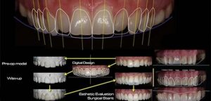 The role of digital imaging in understanding the best shape for a smile