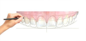 What are the principles of ideal smile design?