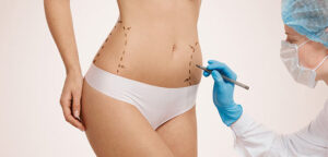 Surgical procedures that help eliminate fat